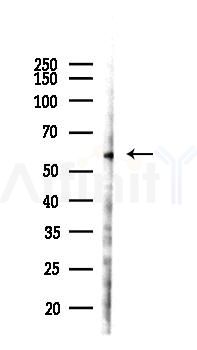 Phospho-Tip60 (Ser90) Antibody - Western blot analysis of lysates from 293 cells(LPS 4h treatment), using Phospho-Tip60 (Ser90) Antibody at 1/1000 dilution.