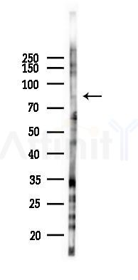Phospho-UBF1 (Ser484) Antibody - Western blot analysis of lysates from B16F10-LUC cells(heat-shock 45min treatment), using Phospho-UBF1 (Ser484) Antibody at 1/1000 dilution.