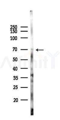 Phospho-IL-2R beta/CD122 (Tyr364) Antibody - Western blot analysis of lysates from Hela cells(starvation 24h treatment), using Phospho-IL-2R beta/CD122 (Tyr364) Antibody at 1/1000 dilution.