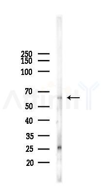 Phospho-B Raf (Thr753) Antibody - Western blot analysis of lysates from B16F10-LUC cells(UV,30min treatment), using Phospho-B Raf (Thr753) Antibody at 1/1000 dilution.
