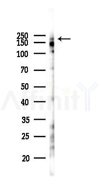 Phospho-Girdin (Ser1417) Antibody - Western blot analysis of lysates from B16F10-LUC cells(heat-shock 45min treatment), using Phospho-Girdin (Ser1417) Antibody at 1/1000 dilution.