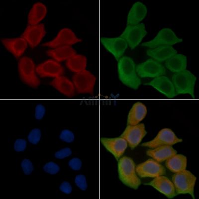 Phospho-Integrin beta 1 (Thr789) Antibody - AF3937 staining Hela cells(45min of heat-shock treatment) by IF/ICC.