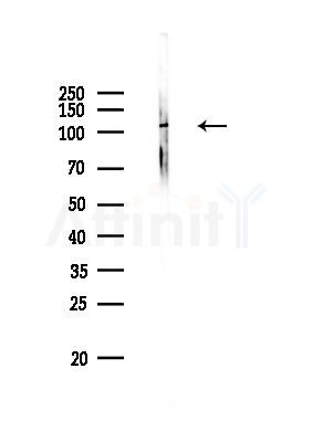 Phospho-EPHA7 (Tyr791) Antibody - Western blot analysis of lysates from Mouse brain, using Phospho-EPHA7 (Tyr791) Antibody at 1/1000 dilution.