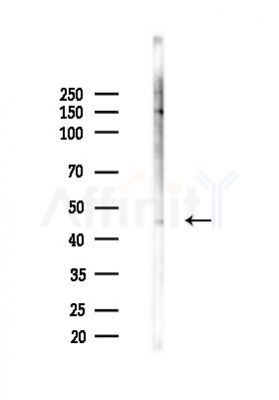 Phospho-PKA-R2 beta (Ser114) Antibody - Western blot analysis of lysates from RAW264.