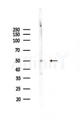 Phospho-PKA-R2 beta (Ser114) Antibody - Western blot analysis of lysates from A2780 cells(starvation,24h treatment), using Phospho-PKA-R2 beta (Ser114) Antibody at 1/1000 dilution.