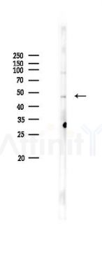 Phospho-HRH1 (Ser398) Antibody - Western blot analysis of lysates from K562 cells(heat-shock 45min treatment), using Phospho-HRH1 (Ser398) Antibody at 1/1000 dilution.