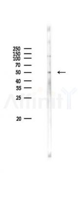 Phospho-HRH1 (Ser398) Antibody - Western blot analysis of lysates from PC12 cells(LPS 4h treatment), using Phospho-HRH1 (Ser398) Antibody at 1/1000 dilution.