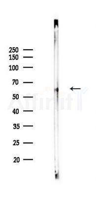 Phospho-TGFBR2 (Ser225/Ser250) Antibody - Western blot analysis of lysates from Mouse lung, using Phospho-TGFBR2 (Ser225/Ser250) Antibody at 1/1000 dilution.
