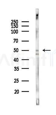 Phospho-Tal1 (Ser122) Antibody - Western blot analysis of lysates from K562 cells(UV 30min treatment), using Phospho-Tal1 (Ser122) Antibody at 1/1000 dilution.