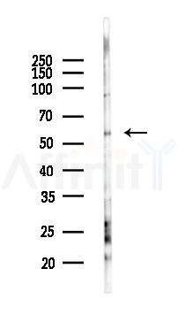 Phospho-AKT1 (Tyr326) Antibody - Western blot analysis of lysates from K562 cells(UV 30min treatment), using Phospho-AKT1 (Tyr326) Antibody at 1/1000 dilution.