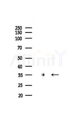 Phospho-TIS11B (Ser92) Antibody - Western blot analysis of lysates from A2780 cells(starvation,24h treatment), using Phospho-TIS11B (Ser92) Antibody at 1/1000 dilution.