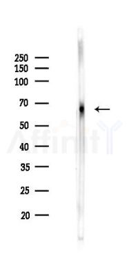 Phospho-C-RAF (Thr269) Antibody - Western blot analysis of lysates from Rat liver, using Phospho-C-RAF (Thr269) Antibody at 1/1000 dilution.