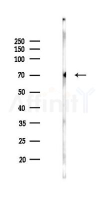 Phospho-Estrogen Receptor alpha (Ser102) Antibody - Western blot analysis of lysates from Rat liver, using Phospho-Estrogen Receptor alpha (Ser102) Antibody at 1/1000 dilution.