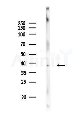 Phospho-ERK1/2 (Tyr205/Tyr222) Antibody - Western blot analysis of lysates from Mouse brain, using Phospho-ERK1/2 (Tyr205/Tyr222) Antibody at 1/1000 dilution.