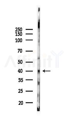 Phospho-p38 MAPK (Thr180/Tyr182) Antibody - Western blot analysis of lysates from K562 cells(UV 30min treatment), using Phospho-p38 MAPK (Thr180/Tyr182) Antibody at 1/1000 dilution.