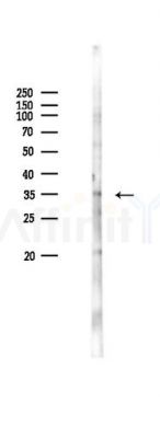 Nanog Antibody - Western blot analysis of lysates from K562 cells(heat-shock 45min treatment), using Nanog Antibody at 1/1000 dilution.