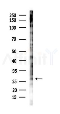 lin28b Antibody - Western blot analysis of lysates from B16F10-LUC cells(starvation 24h treatment), using lin28b Antibody at 1/1000 dilution.