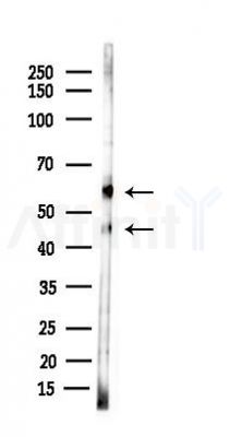 E2F-2 Antibody - Western blot analysis of lysates from B16F10-LUC cells(starvation 24h treatment), using E2F-2 Antibody at 1/1000 dilution.