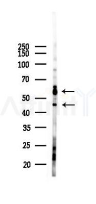 E2F-2 Antibody - Western blot analysis of lysates from 293 cells(LPS 4h treatment), using E2F-2 Antibody at 1/1000 dilution.