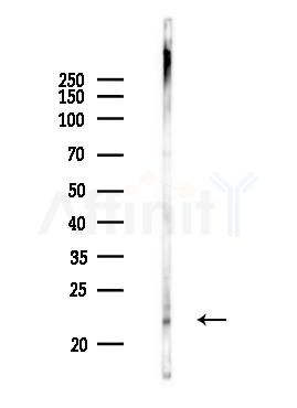 Rac1/cdc42 Antibody - Western blot analysis of lysates from Mouse brain, using Rac1/cdc42 Antibody at 1/1000 dilution.