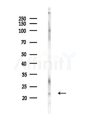 Rac1/cdc42 Antibody - Western blot analysis of lysates from Rat testis, using Rac1/cdc42 Antibody at 1/1000 dilution.