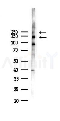 VEGFR3 Antibody - Western blot analysis of lysates from 293 cells(LPS 4h treatment), using VEGFR3 Antibody at 1/1000 dilution.