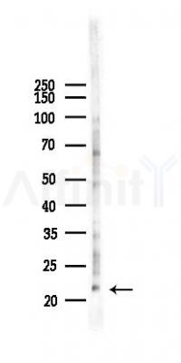Acetyl-Histone H3 (Lys14) Antibody - Western blot analysis of lysates from 293 cells(LPS 4h treatment), using Acetyl-Histone H3 (Lys14) Antibody at 1/1000 dilution.