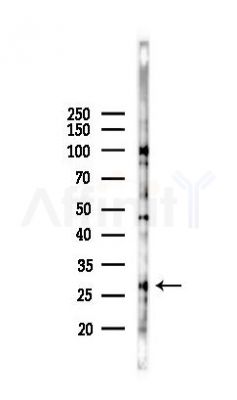 Phospho-LAT (Tyr191)[Tyr220] Antibody - Western blot analysis of lysates from HUVEC cells(starvation 24h treatment), using Phospho-LAT (Tyr191)[Tyr220] Antibody at 1/1000 dilution.
