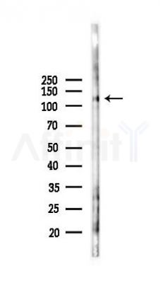 Phospho-MCSF Receptor (Tyr723) Antibody - Western blot analysis of lysates from HUVEC cells(starvation 24h treatment), using Phospho-MCSF Receptor (Tyr723) Antibody at 1/1000 dilution.