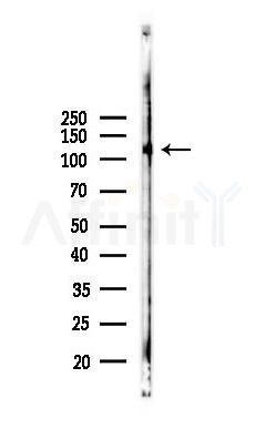 Phospho-MCSF Receptor (Tyr923) Antibody - Western blot analysis of lysates from HUVEC cells(starvation 24h treatment), using Phospho-MCSF Receptor (Tyr923) Antibody at 1/1000 dilution.