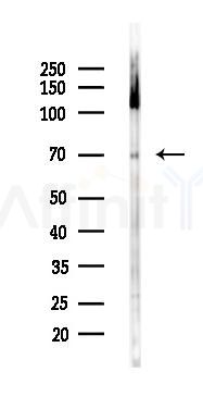 Phospho-Ku70 (Ser520) Antibody - Western blot analysis of lysates from Mouse liver, using Phospho-Ku70 (Ser520) Antibody at 1/1000 dilution.