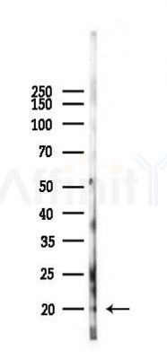 Phospho-PEA15 (Ser116) Antibody - Western blot analysis of lysates from 293 cells(LPS 4h treatment), using Phospho-PEA15 (Ser116) Antibody at 1/1000 dilution.