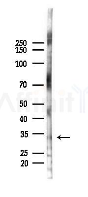 Casein Kinase 1 alpha Antibody - Western blot analysis of lysates from Mouse testis, using Casein Kinase 1 alpha Antibody at 1/1000 dilution.