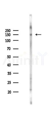 SIN3A Antibody - Western blot analysis of lysates from Mouse lung, using SIN3A Antibody at 1/1000 dilution.