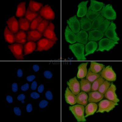 KIBRA Antibody - AF4617 staining Hela cells(45min of heat-shock treatment) by IF/ICC.