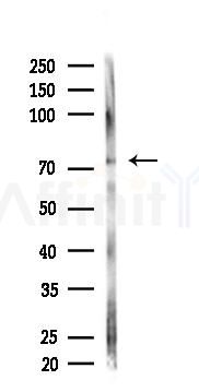 PABP1 Antibody - Western blot analysis of lysates from Hela cells(starvation 24h treatment), using PABP1 Antibody at 1/1000 dilution.