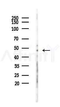 Thrombin Receptor Antibody - Western blot analysis of lysates from B16F10-LUC cells(starvation 24h treatment), using Thrombin Receptor Antibody at 1/1000 dilution.
