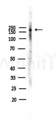 LRP5 Antibody - Western blot analysis of lysates from PC12 cells(LPS 4h treatment), using LRP5 Antibody at 1/1000 dilution.