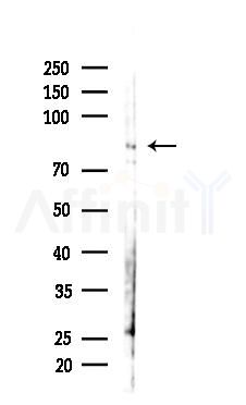 PI3K p85 alpha Antibody - Western blot analysis of lysates from Hela cells(starvation 24h treatment), using PI3K p85 alpha Antibody at 1/1000 dilution.