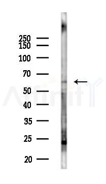IRAK2 Antibody - Western blot analysis of lysates from 293 cells(LPS 4h treatment), using IRAK2 Antibody at 1/1000 dilution.