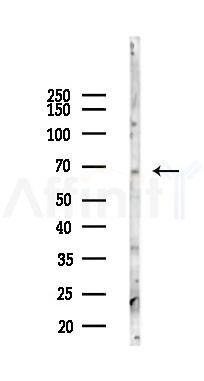 IRAK3 Antibody - Western blot analysis of lysates from 293 cells(LPS 4h treatment), using IRAK3 Antibody at 1/1000 dilution.