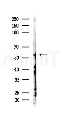 IRAK4 Antibody - Western blot analysis of lysates from Hela cells(starvation 24h treatment), using IRAK4 Antibody at 1/1000 dilution.