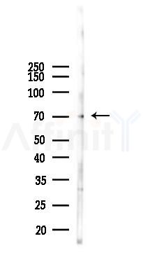 TAK1 Antibody - Western blot analysis of lysates from 293 cells(UV 30min treatment), using TAK1 Antibody at 1/1000 dilution.