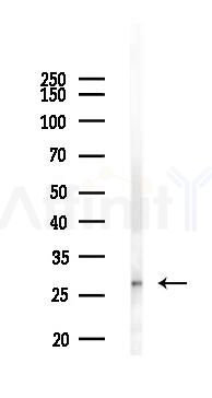 LAT Antibody - Western blot analysis of lysates from 293 cells(LPS 4h treatment), using LAT Antibody at 1/1000 dilution.