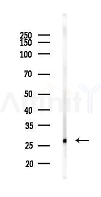 LAT Antibody - Western blot analysis of lysates from Rat brain, using LAT Antibody at 1/1000 dilution.