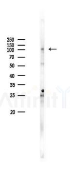 ULK1 Antibody - Western blot analysis of lysates from K562 cells(heat-shock 45min treatment), using ULK1 Antibody at 1/1000 dilution.