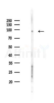 TrkA Antibody - Western blot analysis of lysates from Rat liver, using TrkA Antibody at 1/1000 dilution.