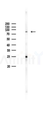TrkA Antibody - Western blot analysis of lysates from K562 cells(heat-shock 45min treatment), using TrkA Antibody at 1/1000 dilution.