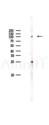 TrkA Antibody - Western blot analysis of lysates from PC12 cells(LPS 4h treatment), using TrkA Antibody at 1/1000 dilution.