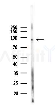 Insulin Receptor beta Antibody - Western blot analysis of lysates from 293 cells(UV 30min treatment), using Insulin Receptor beta Antibody at 1/1000 dilution.